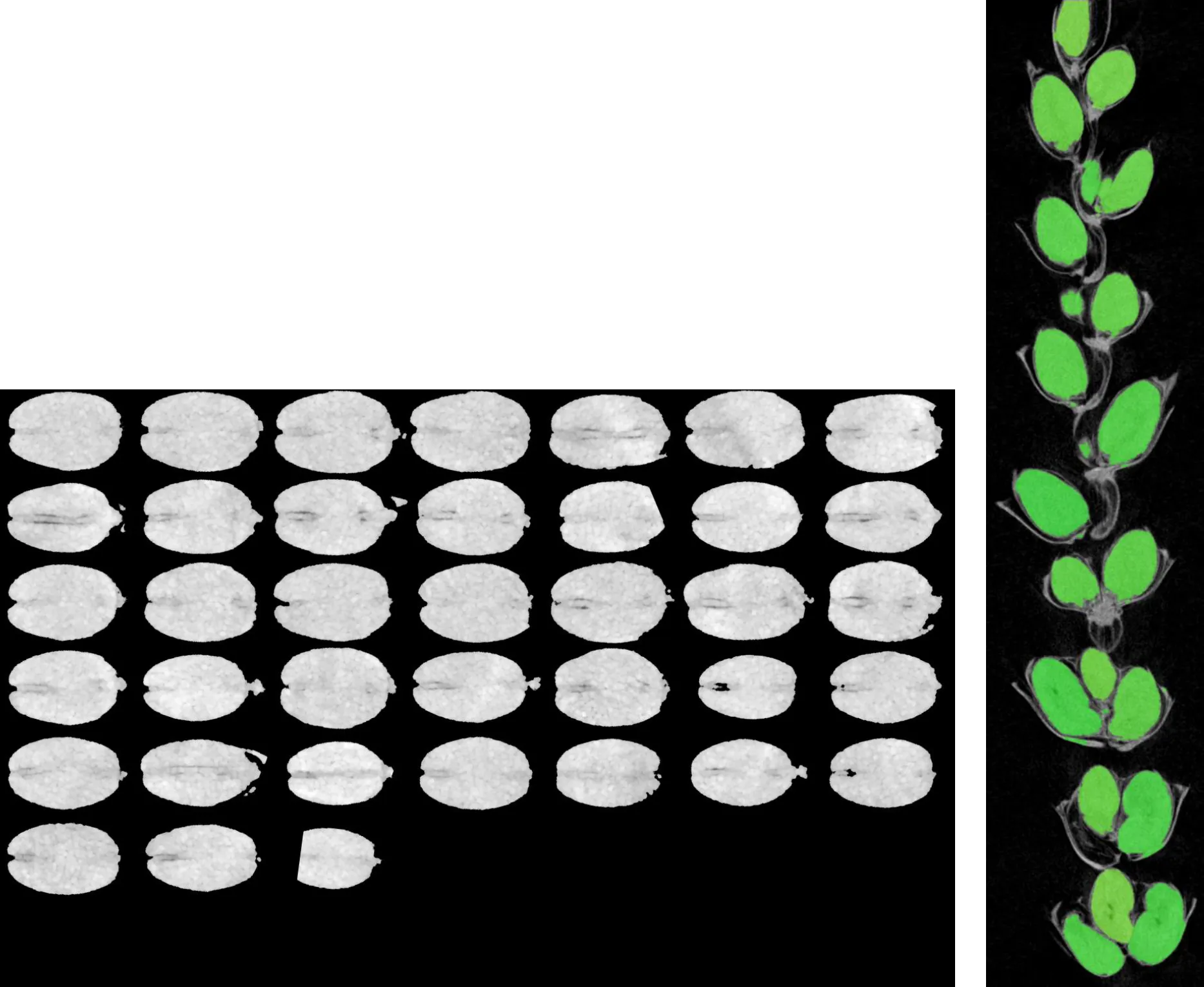 Output image samples visualizing individual grains segmented non destructively from whole ear.